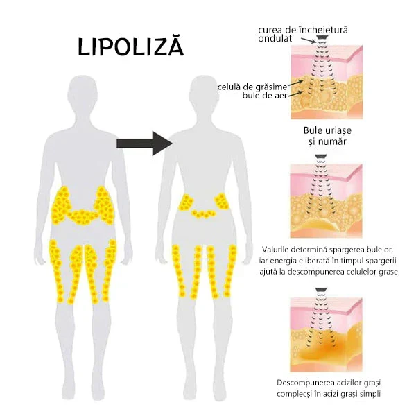 🌻J0SFITTM Ultrazvučni program detoksikacije i sagorijevanja masti