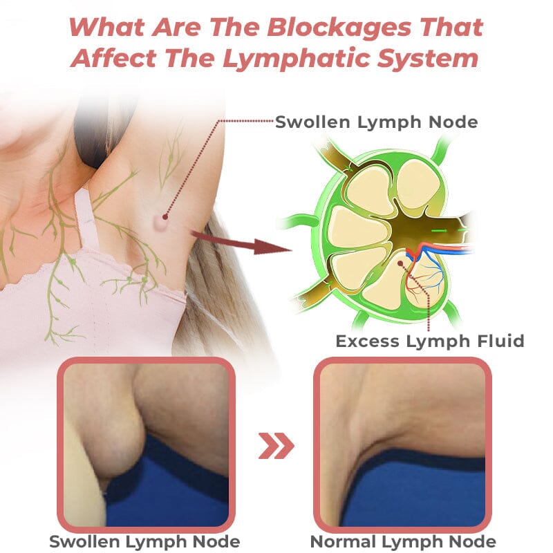FLYSMUS™ LYMPHFLOW МАГНИТОГЕННИ ОБЕЦИ