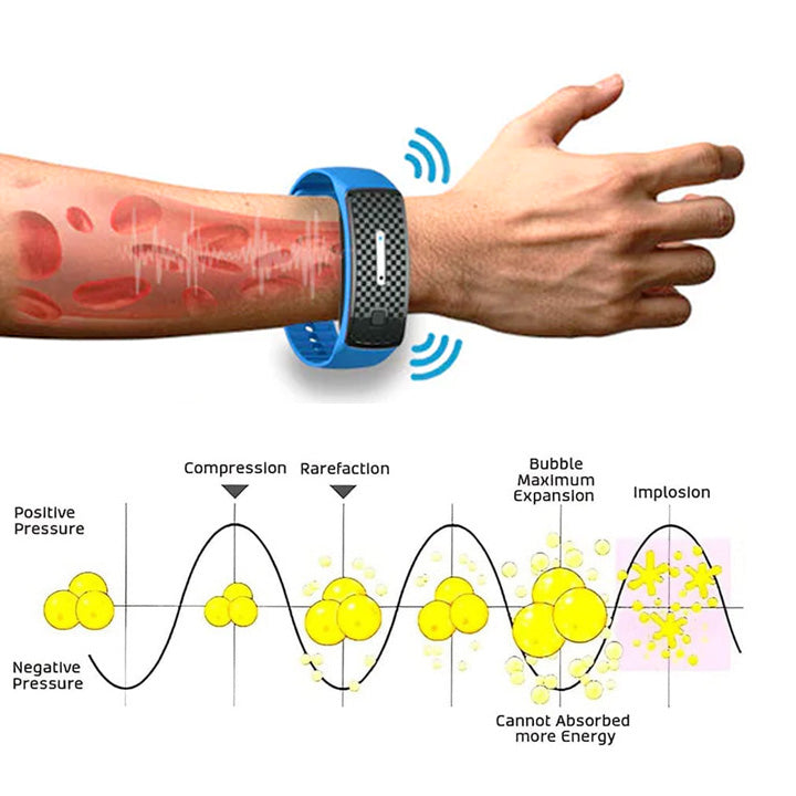 (🔥ПОСЛЕДНИЯ ДЕН 70% ОТСТЪПКА) ULTRASONIC BODY SHAPE WRISTBAND PRO）