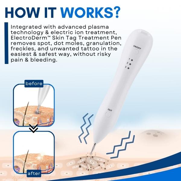 ELECTRODERM™ ПИСАЛКА ЗА ТРЕТИРАНЕ НА КОЖНИ МАРКЕРИ
