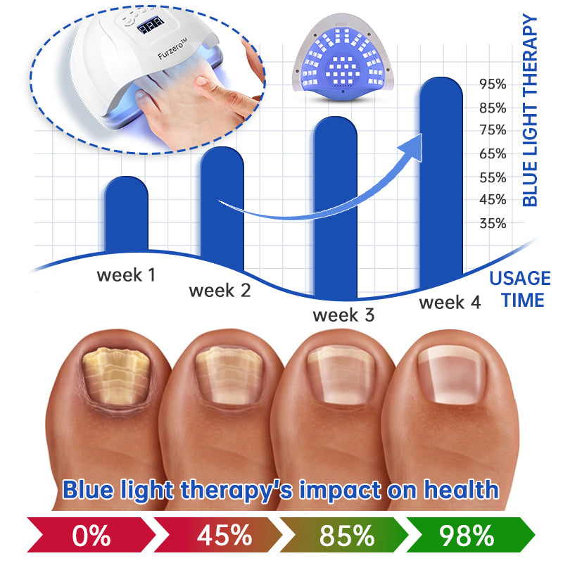 Dispositivo de tratamento de fungos a laser Furzero™ PureNail