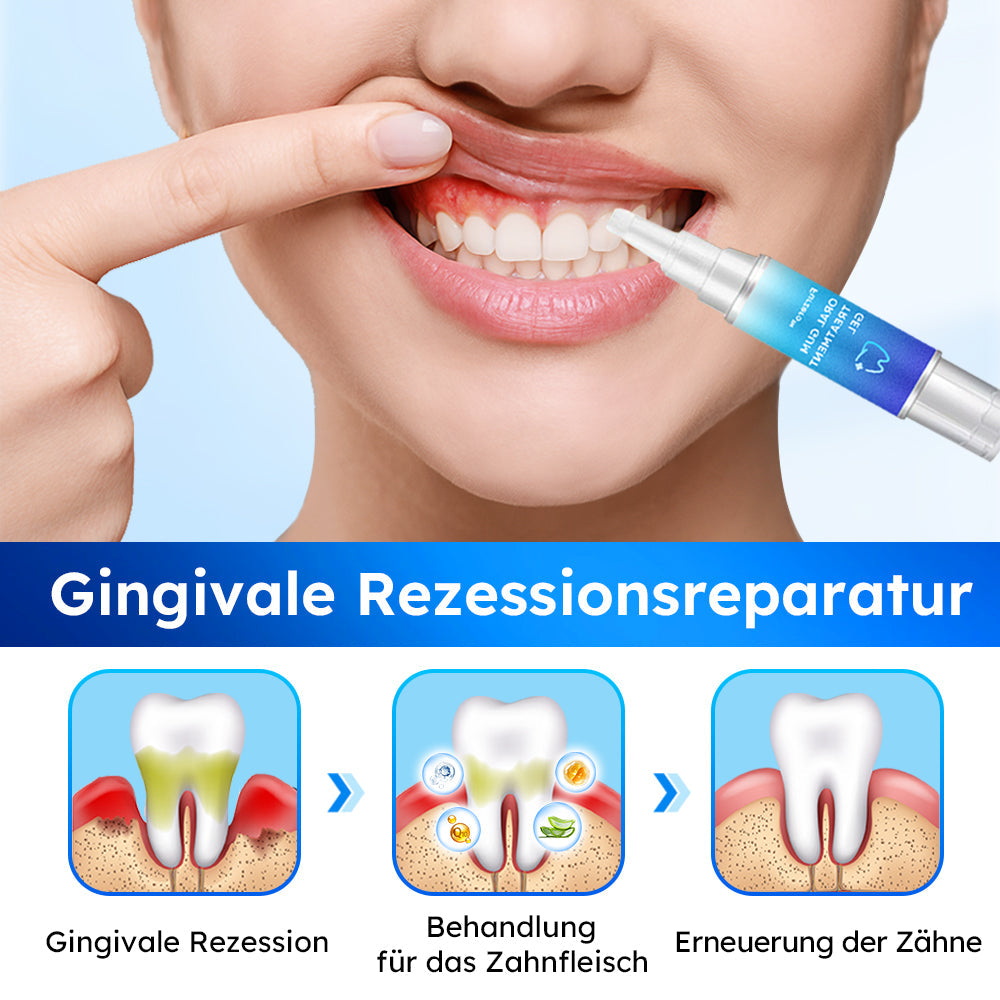 Furzero™ Gel Oral para Tratamento de Gengivas