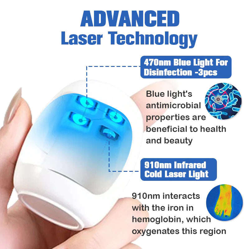 Laserový odstraňovač nechtovej plesne Furzero™