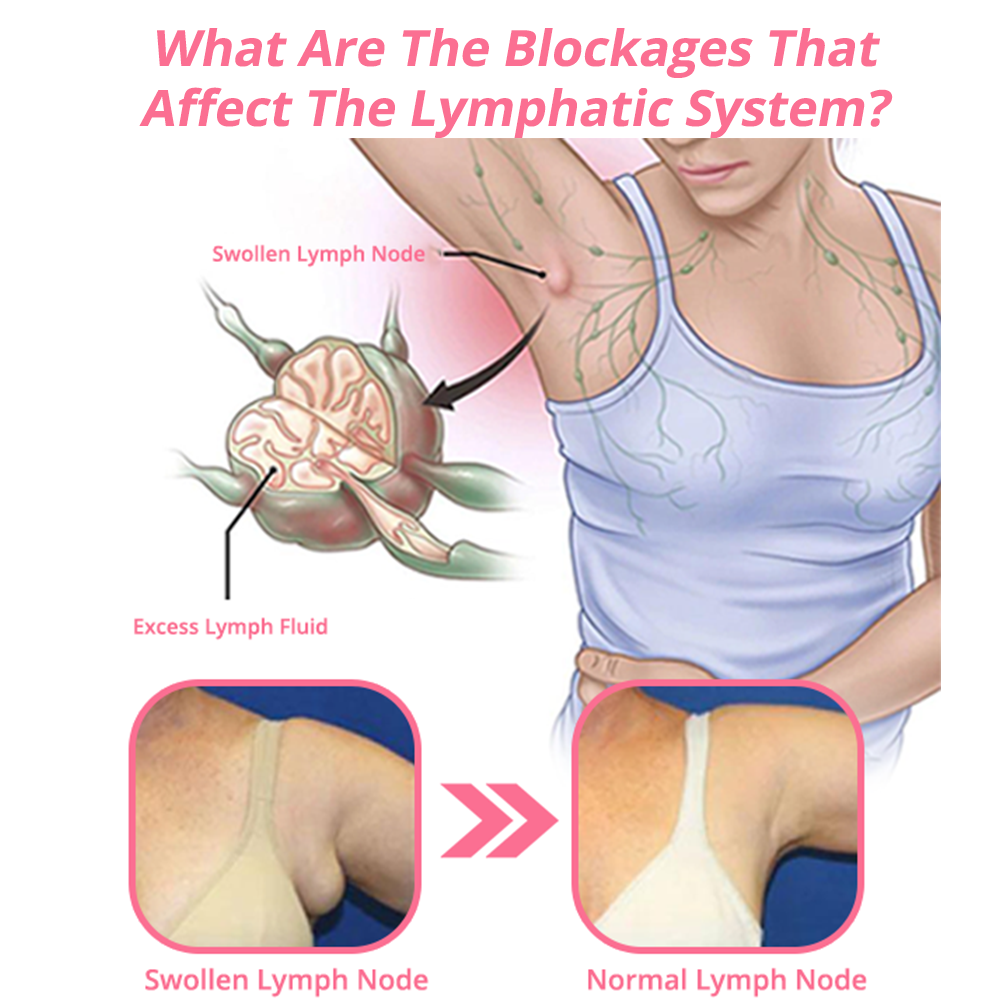 FLYSMUS™ LYMPHVITY MAGNETHERAPY ГЕРМАНИЕВИ ОБЕЦИ